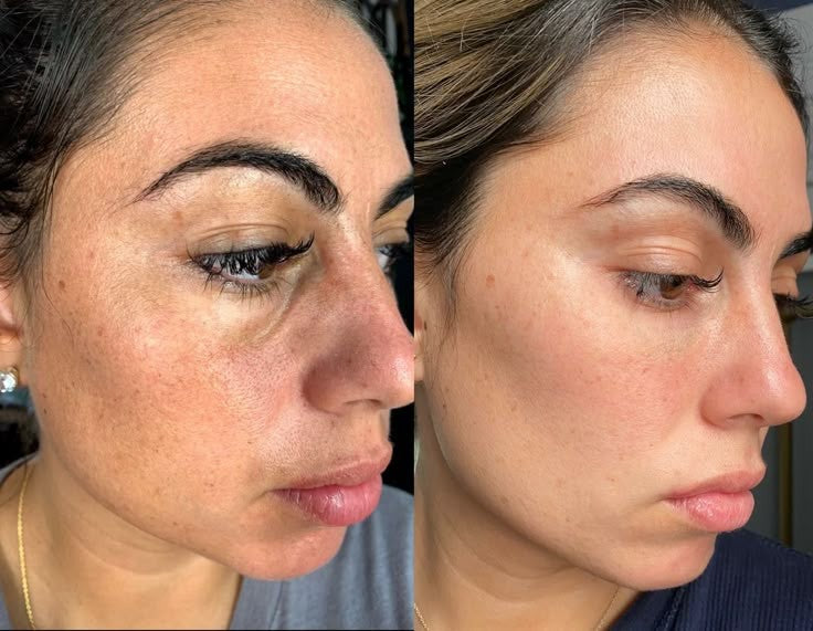 Anti Aging Facial