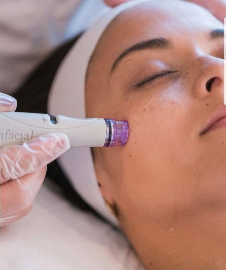 Hydro Facial